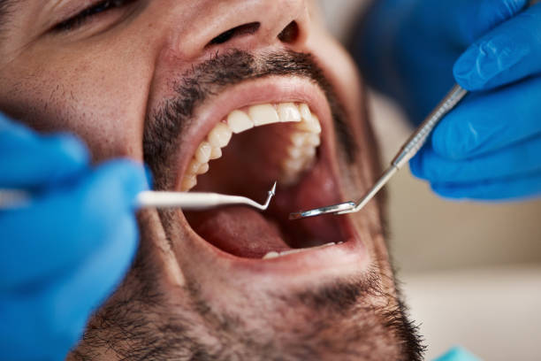 Best Emergency Tooth Extraction  in Montgomery, IN